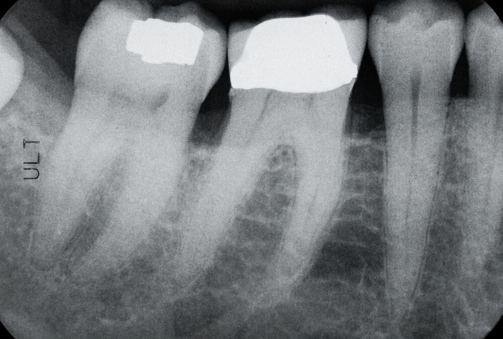 Dr Hosam Alharbi | Estimating Human Age Using Wide View Digital Dental Images